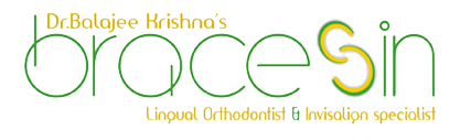 Bracesin